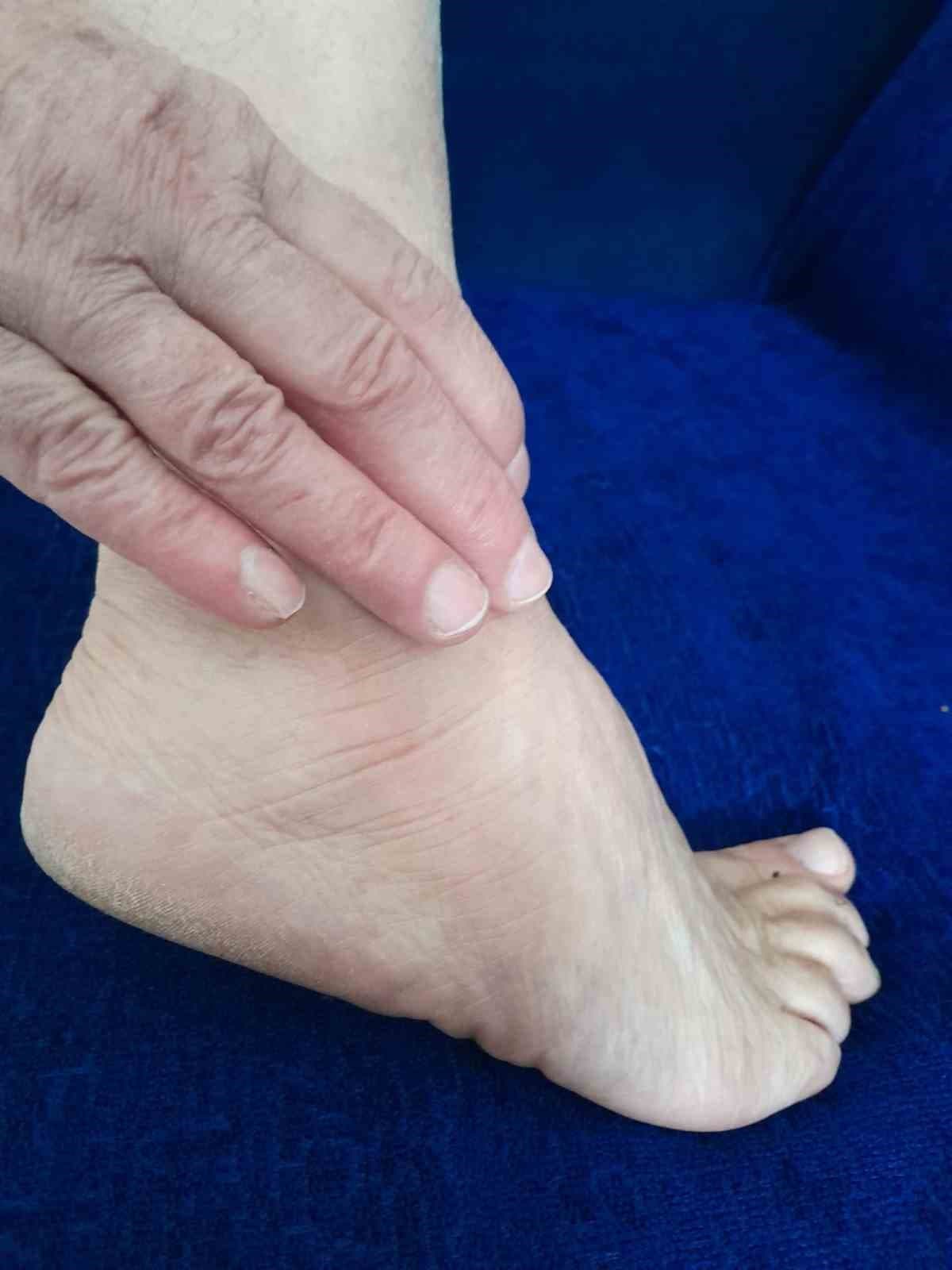 Prof. Dr. Karalezli: "Ayak bileği burkulmalarını ciddiye alın"