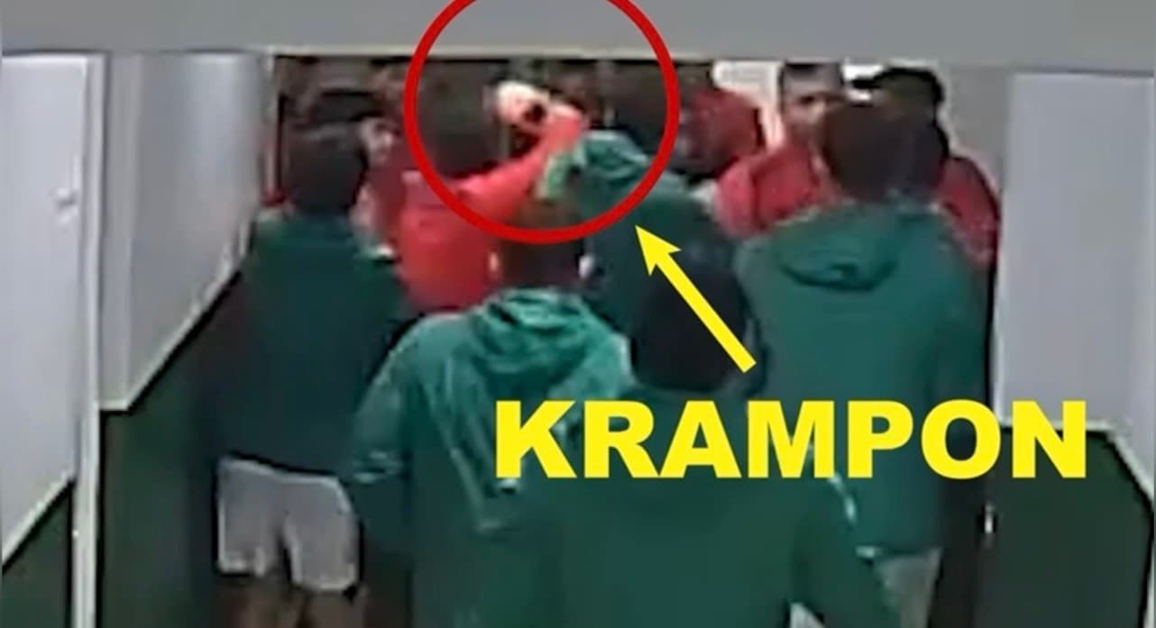 Maç öncesi ortalık karıştı: Futbolcular kramponlarla darbedildi