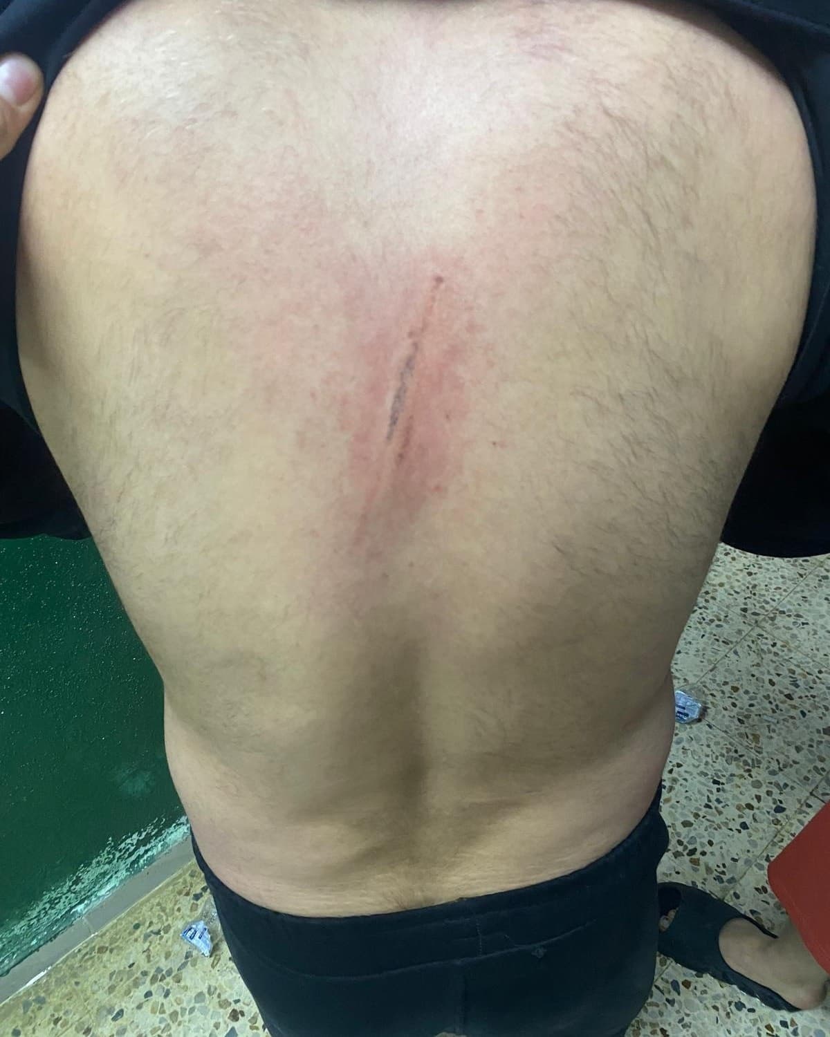 Maç öncesi ortalık karıştı: Futbolcular kramponlarla darbedildi